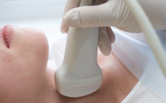 Hipotireoidismo SAÚDE - MUITO ALÉM DA ALIMENTAÇÃO: 7 RAZÕES OCULTAS PARA VOCÊ ESTA ENGORDANDO Hipotireoidismo