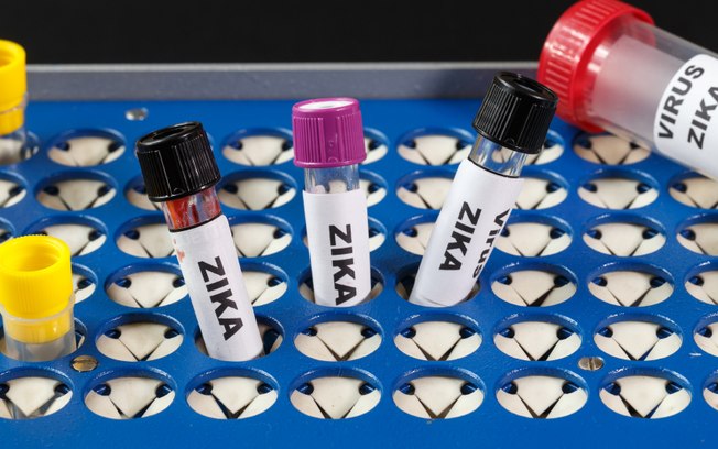 Três testes para a detecção do zika vírus serão cobertos pelos planos de saúde a partir de julho deste ano - Testes de detecção do zika vírus serão cobertos pelos planos de saúde 